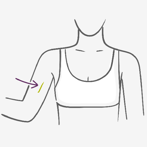 Contraceptive Implant How to use